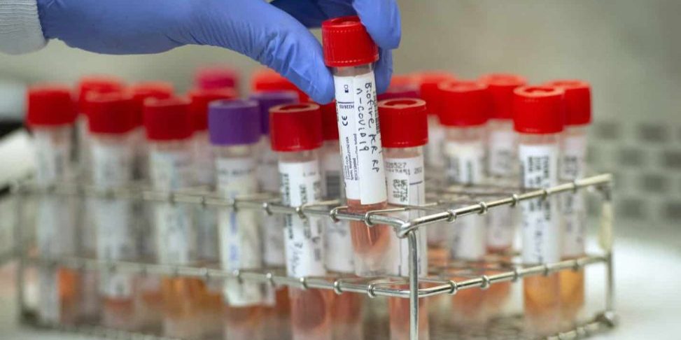 Coronavirus test tubes
